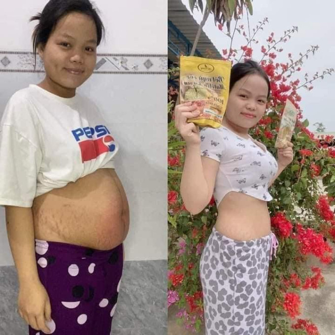 Cơ chế hỗ trợ đốt cháy mỡ thừa của Bột Ngũ Cốc Matcha Lá Sen