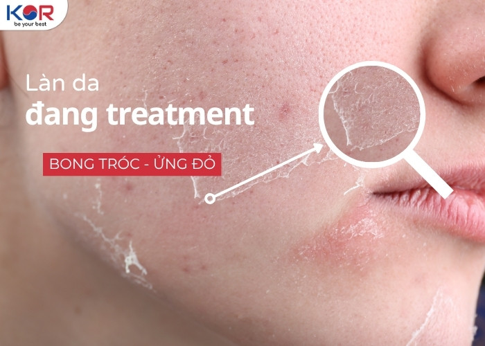 Hình ảnh đặc trưng của làn da đang điều trị treatment