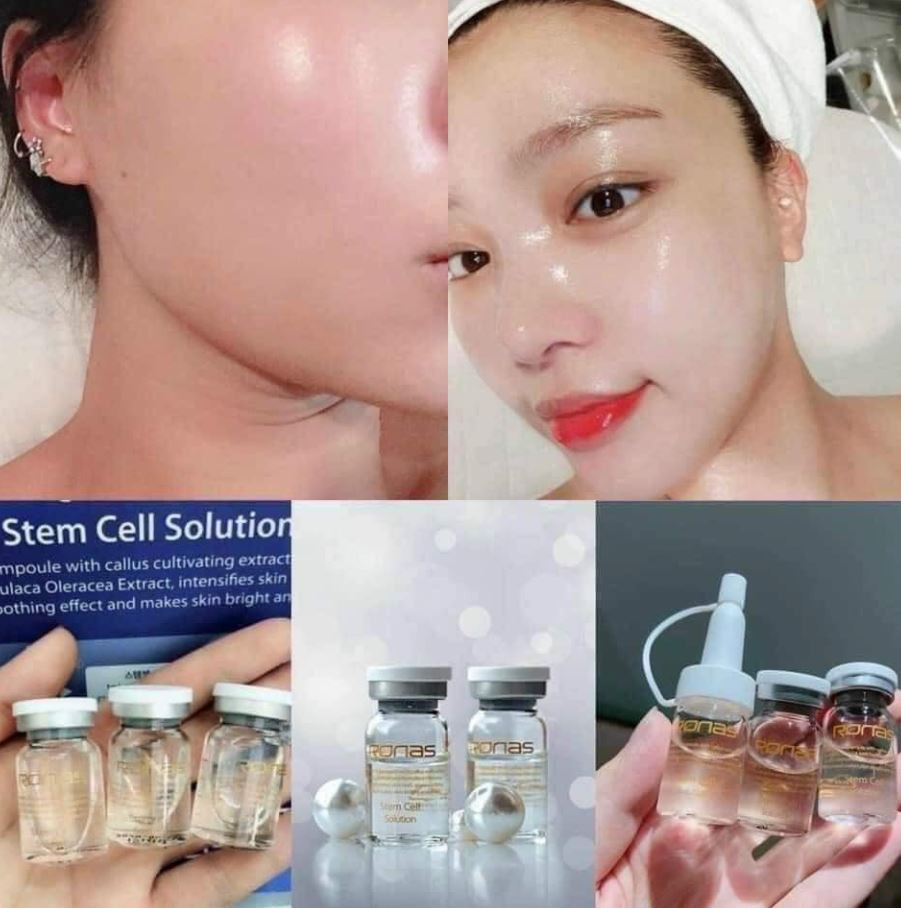 Hình ảnh sản phẩm Tế bào gốc Ronas Stem Cell Solution