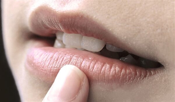 Môi thâm sạm làm giảm sự tự tin và thẩm mỹ